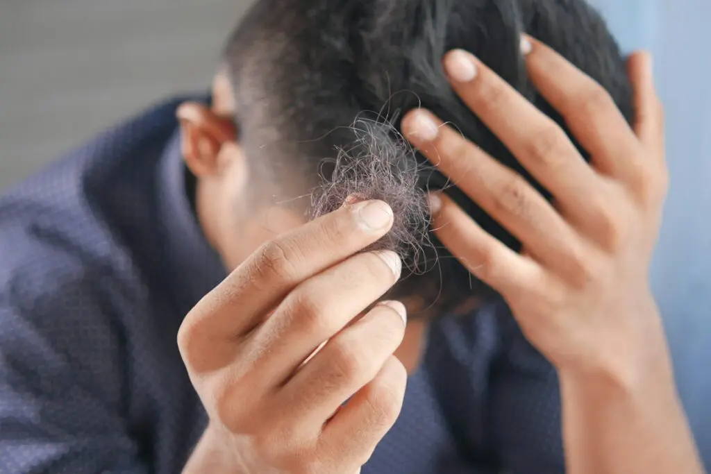 Man examining a handful of fallen hair with concern.